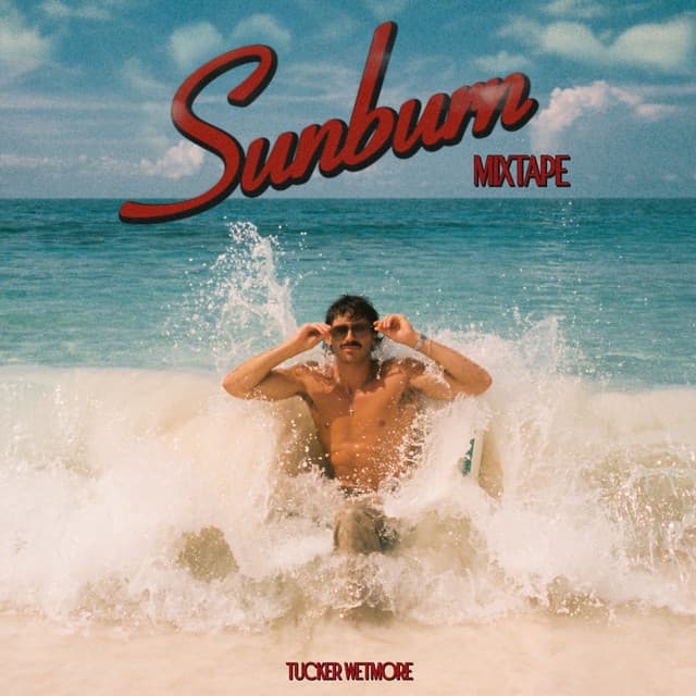 Sunburn