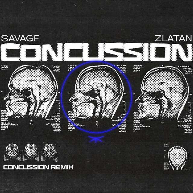 Concussion - Remix